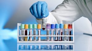 Sağlık ve bakım alanında uzman evde bakım hizmetleri, kan testi ve laboratuvar hizmetleri.